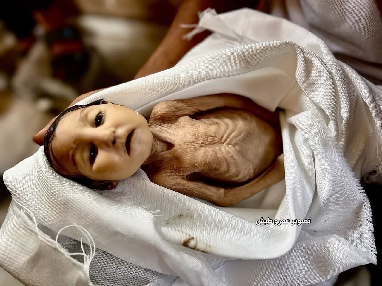 DR. AHMED EL FERRA: GAZZE